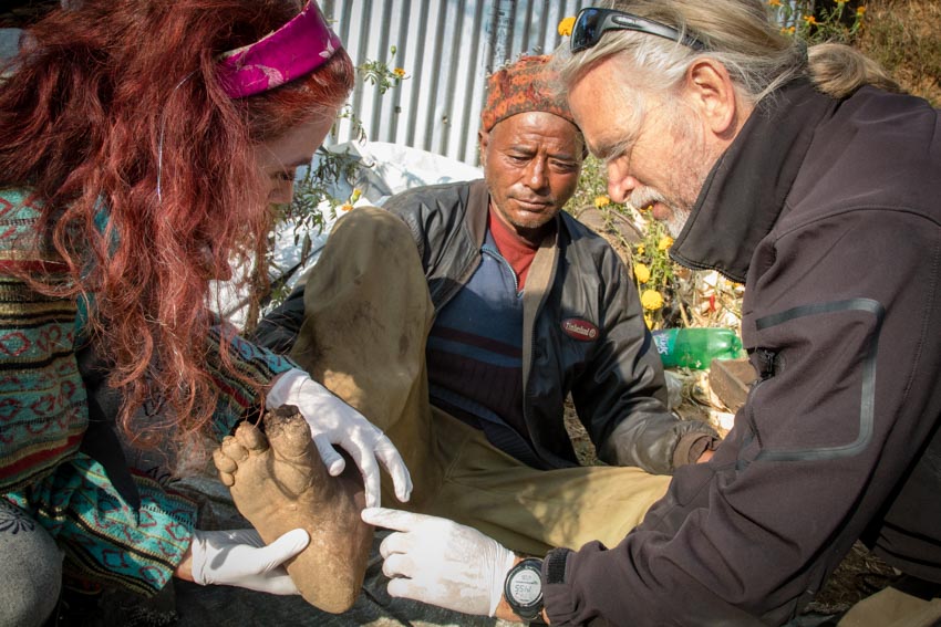 Acupuncture Relief Project  | Good Health Nepal | Andrew Schlabach