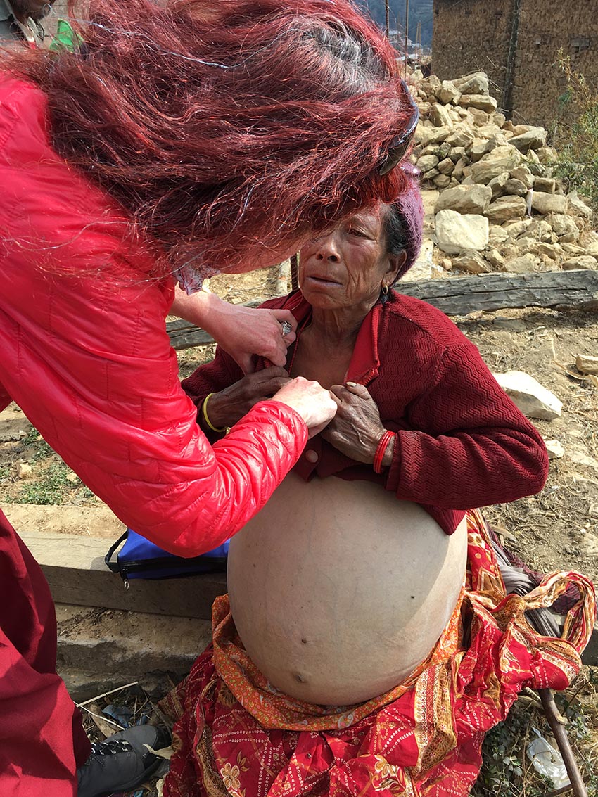 Acupuncture Relief Project  | Good Health Nepal | Andrew Schlabach