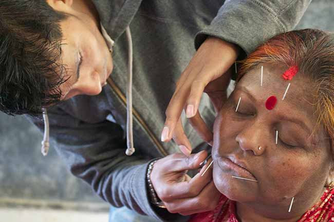 Acupuncture Relief Project  | Good Health Nepal | Andrew Schlabach