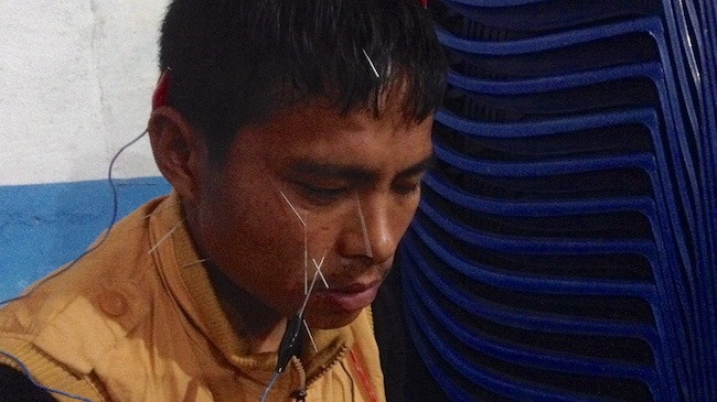 Asiya Shoot | Acupuncture Volunteer Nepal