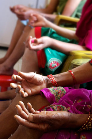 Women in Nepal | Acupuncture Clinic